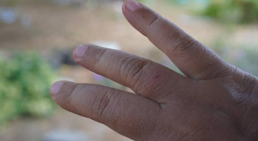 Ádám ujjvégét levágta egy tálca a gödi Samsung-gyárban: a cég szólt, hogy otthoni balesetként jelentse