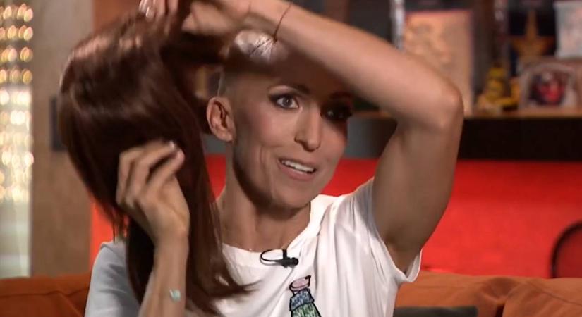 Levette parókáját: rákbetegségéről vallott Rubint Réka