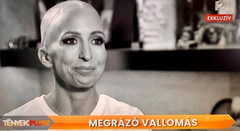 Kiderült az igazság Rubint Réka betegségéről: rákkal küzd a fitneszedző