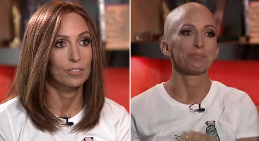 Rubint Réka a TV2 kamerái előtt vette le parókáját, és sírva beszélt betegségéről