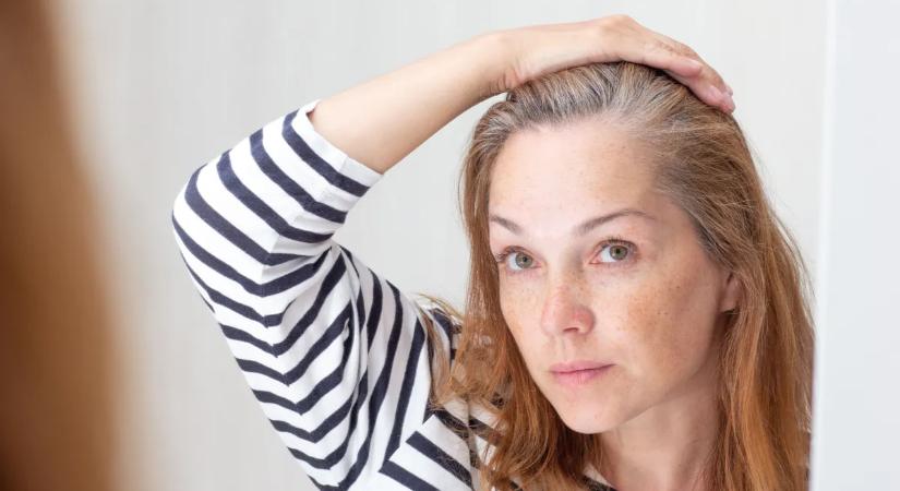 Természetesen ősz tincsekre váltanál? 5 praktika a festett haj lenövesztéséhez