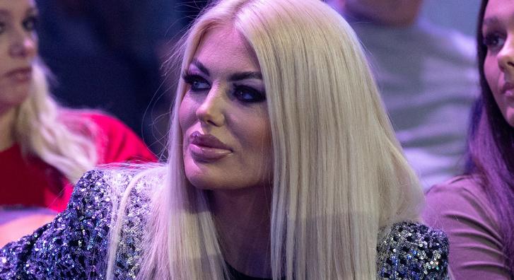 „Zavart, hogy ilyen nagy, ezért kiszedettem” – Géczi Bea megszabadult a szilikontól, sokkoló műtétjéről mesélt