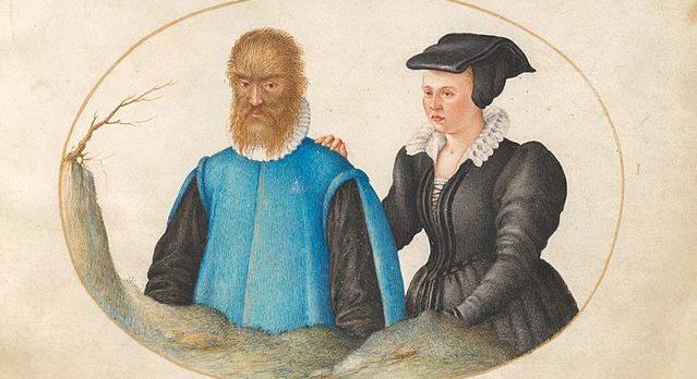 A valódi Szépség és a Szörnyeteg – Petrus Gonsalvus és családja története