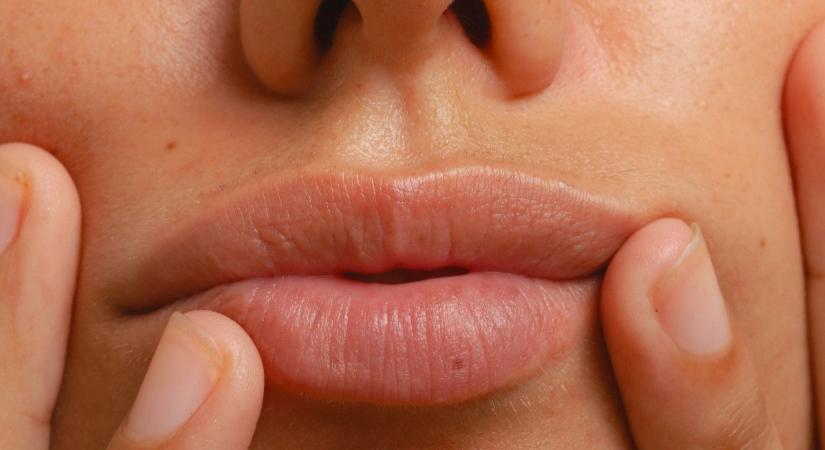 A szájon jelentkezhet először ennek a szívbeteségnek a tünete – Mire figyelj?