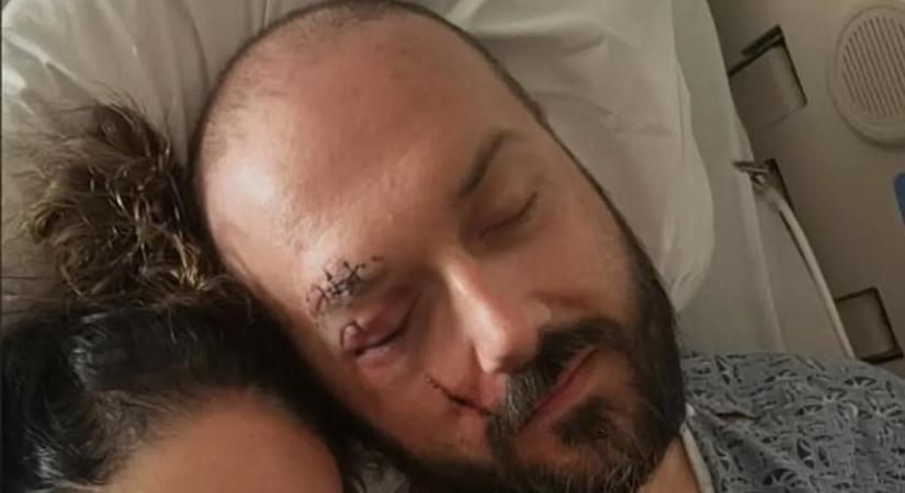 Tragédia a 10. évfordulón: Az influenszer férjét vérző fejjel találták meg egy hotel előtt