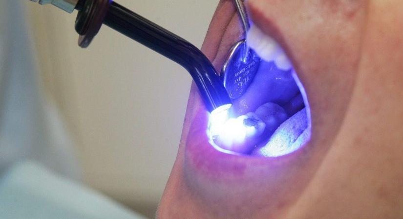 Találtak egy vegyületet, ami megállíthatja a fogszuvasodást