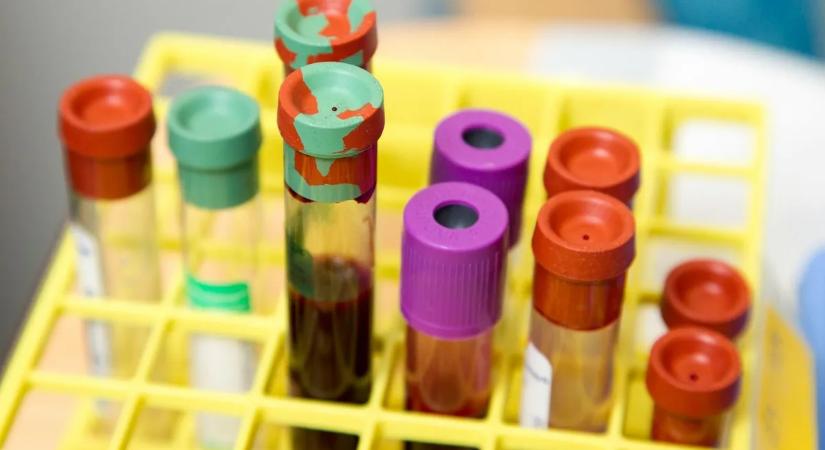 Meglepő, mit árulhat el az egészségéről a vércsoportja