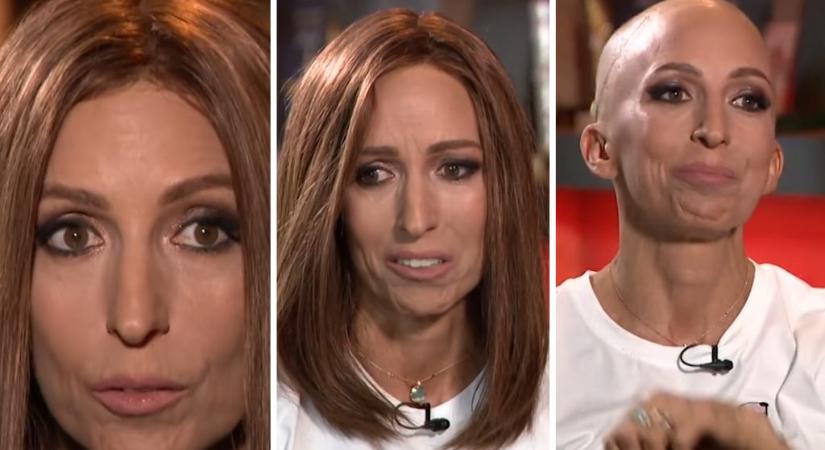 Rubint Réka interjúja a Naplónak: „Norbi a nyugtatókat whiskyvel szedte, a kezelésemnek pedig az volt a veszélye, hogy kilyukad a légcsövem”