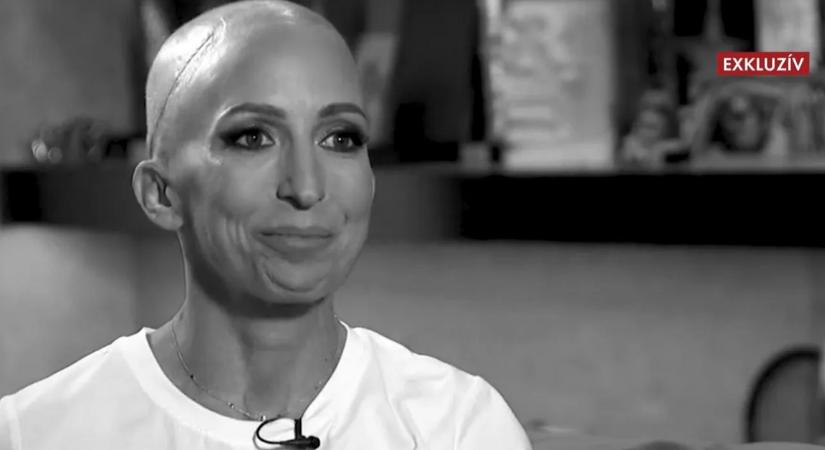 Rubint Réka könnyek között nyilatkozott a betegségéről: „Én az altatásból arra ébredtem, hogy ez sajnos egy rosszindulatú daganat”