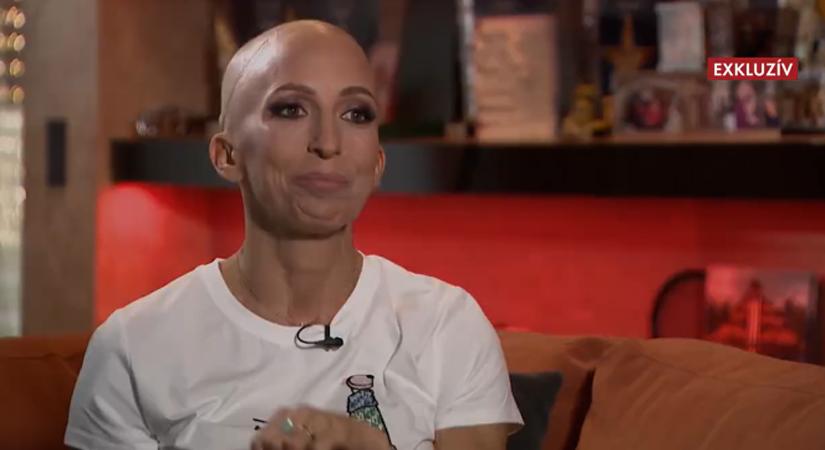 Rubin Réka: „Teljesen szétégett a nyelőcsövem a sugárkezelésektől” – őszintén vallott a rákkal vívott küzdelméről