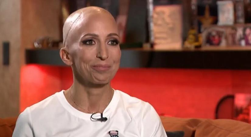 „Nem lehet, hogy egy horrorfilmnek megint én vagyok a főszereplője” – Élő adásban vette le parókáját a rákbeteg Rubint Réka