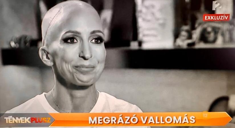 Rubint Réka a rákbetegségéről: „Az altatásból arra ébredtem, hogy ez sajnos egy rosszindulatú daganat”