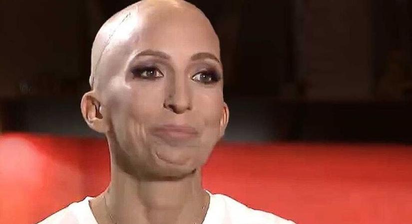 Megrázó részleteket osztott meg betegségéről Rubint Réka