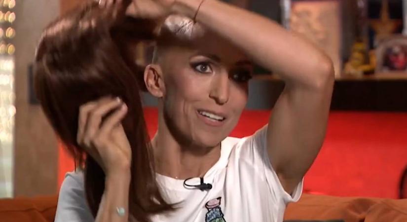 Rubint Réka megdöbbentő részleteket árult el rákbetegségéről: „a parókával eggyé kellett válnom”