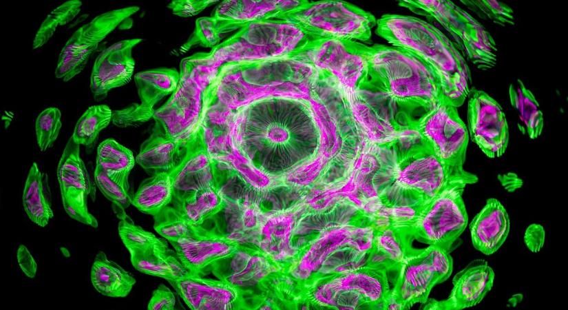 A PEComa rák tünetei így ismerhetőek fel