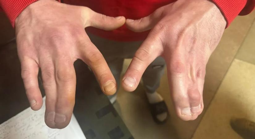 Súlyos betegeket és fogyatékossággal élőket is fogva tartanak az ukrán toborzóközpontokban