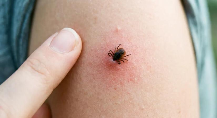 7 súlyos kullancs által terjesztett betegség, amiről sokan nem is tudnak