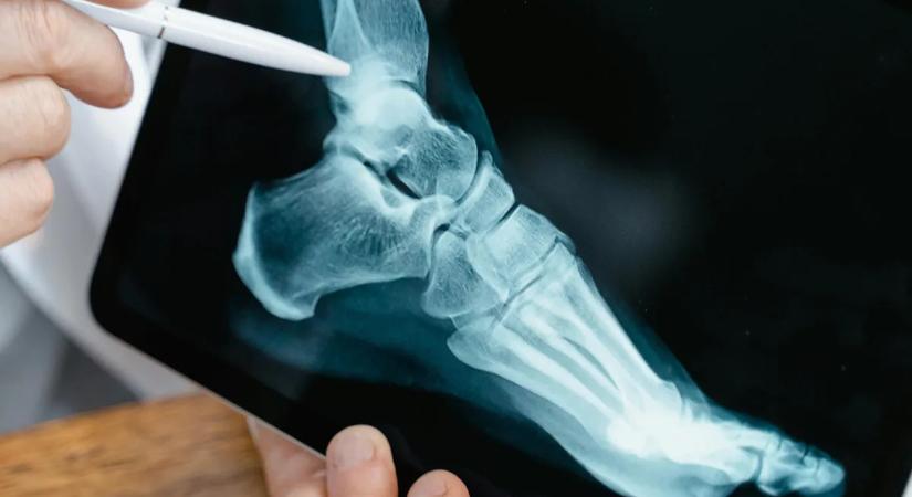 Hihetetlen! Egy német kutatócsapat gombnyomásra erősítheti csontjainkat