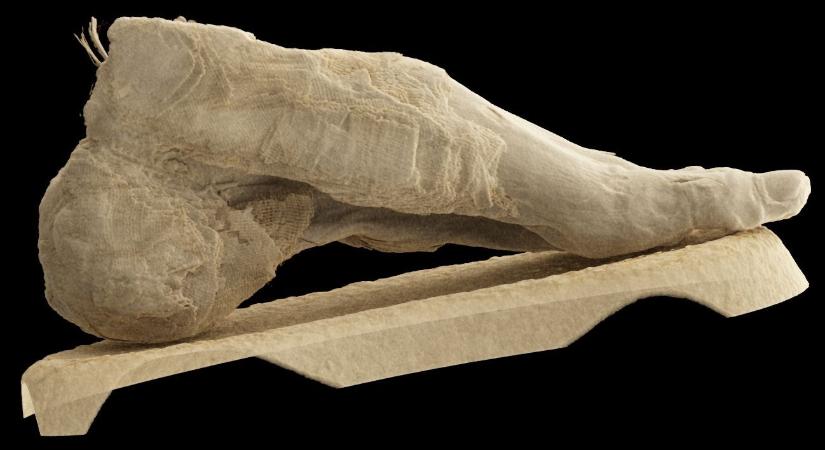 Mit keresett egy ősi maradvány a Semmelweis klinika CT-jében?