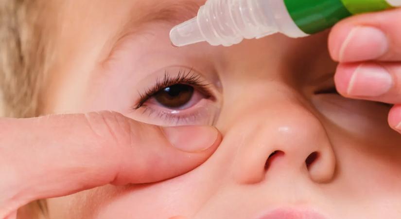 Kötőhártya-gyulladás a gyereknél: nem mindegy, mi okozza