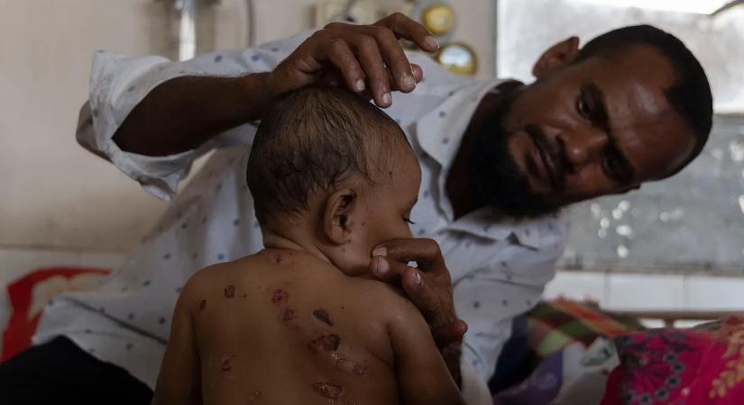 Spóroltak az oltóanyag-beszerzésen: ki is tört a halálos járvány a 170 milliós Bangladesben