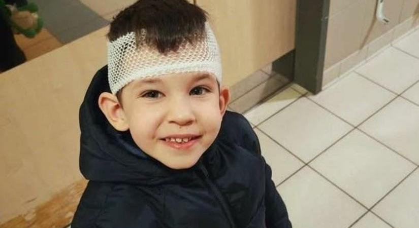 Mosolyogva ment be a traumatológiára a vérző kisfiú, Balázs nevét sosem felejti el a család
