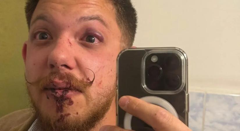 A Tisza-szlogen kiabálása miatt vertek véresre három fiatalt a Sepsi OSK edzői