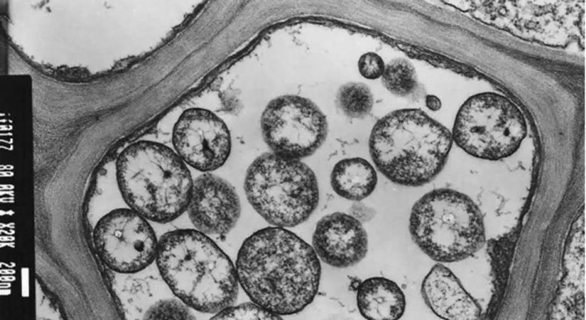 Figyelmeztet a hatóság: ezt a betegséget nem szabad félvállról venni