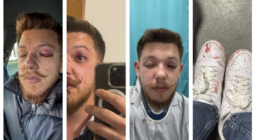 Magyar foci: Verekedési ügybe keveredtek a Sepsi edzői és sportigazgatója, közleményt adtak ki