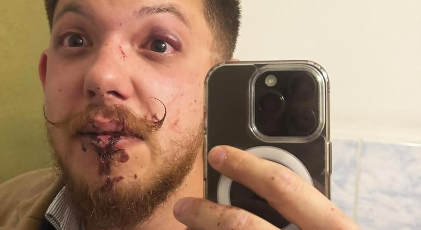 Azt skandálták a fiatalok, hogy „Árad a Tisza!”, véresre verték őket Sepsiszentgyörgyön