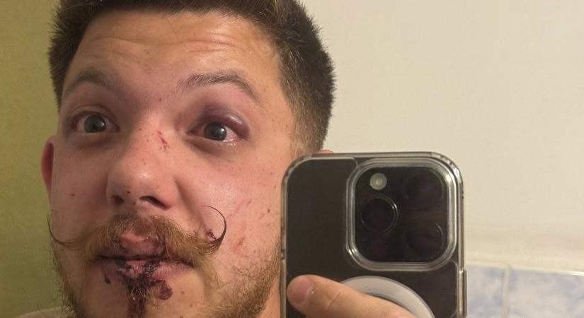 „Árad a Tisza” – skandálta három fiatal Sepsiszentgyörgyön. Megtámadták őket