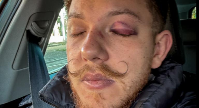 Futballisták vertek véresre egy tiszás tüntetőt Sepsiszentgyörgyön, amiért a párt szlogenjét skandálta