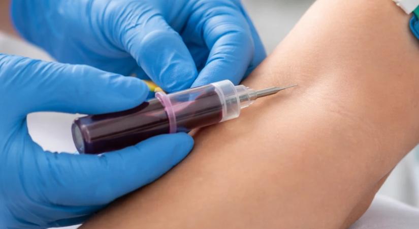 Vérvétel – ez a szám jelzi, meddig élhetsz!