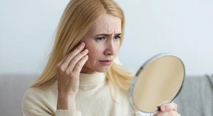 Melanoma vagy öregségi folt? Így különböztesd meg a kettőt