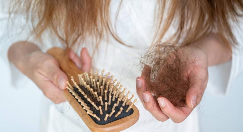 „Marokszám hullik a hajam” – szoros kontyok és szépségtrendek miatt hullik durván a Z generáció haja