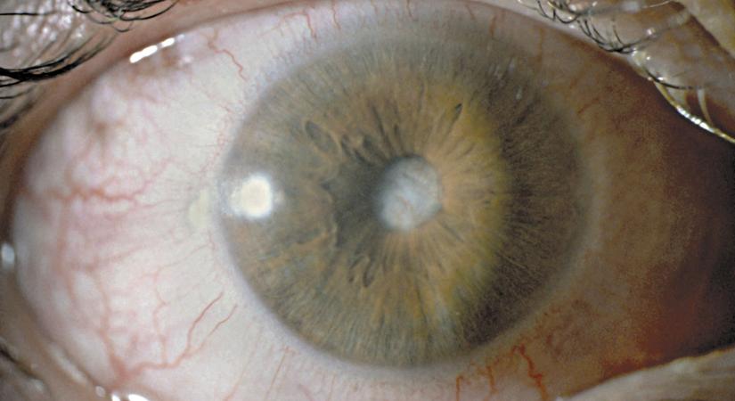 Idén indul az első klinikai teszt a sejtek öregedésének visszafordítására