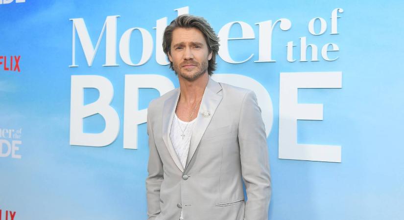 Senki sem látta még így: teljesen másképp nézett ki a jóképű színész az orrsérülése előtt