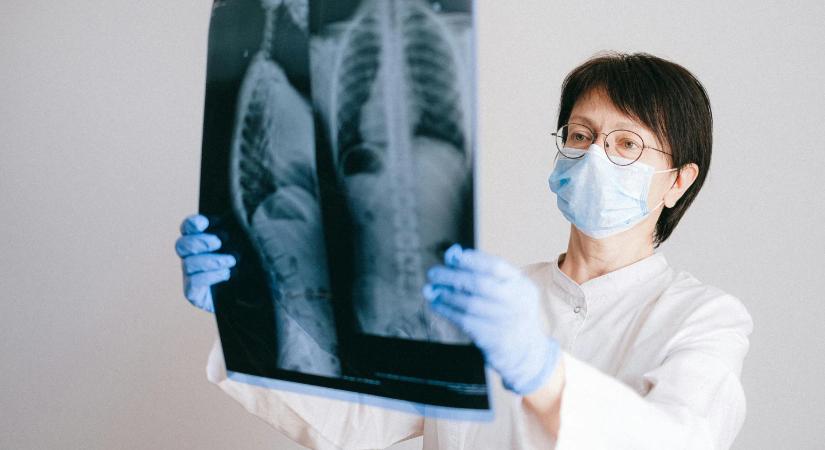 Csendben ölhet: így támad a tüdőrák azoknál is, akik sosem gyújtottak rá