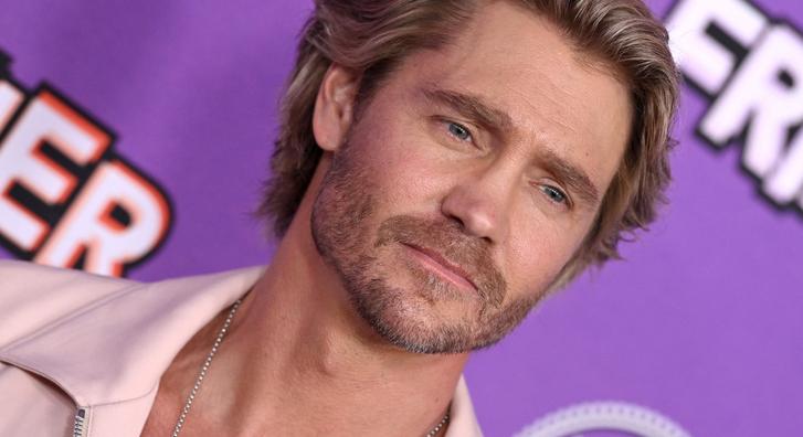 Rá sem lehet ismerni régi fotóján Chad Michael Murrayre, így nézett ki a plasztikai műtétje előtt