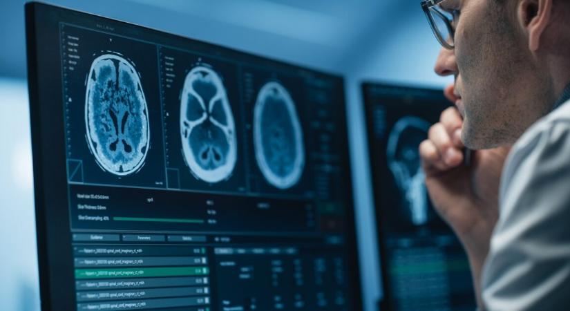 Meglepő, mennyien nem tudják, mi történik az aggyal halál után