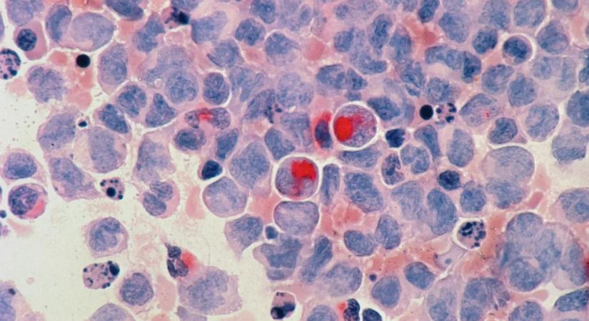 Ez a nap életeket menthet – sokan mégsem veszik elég komolyan