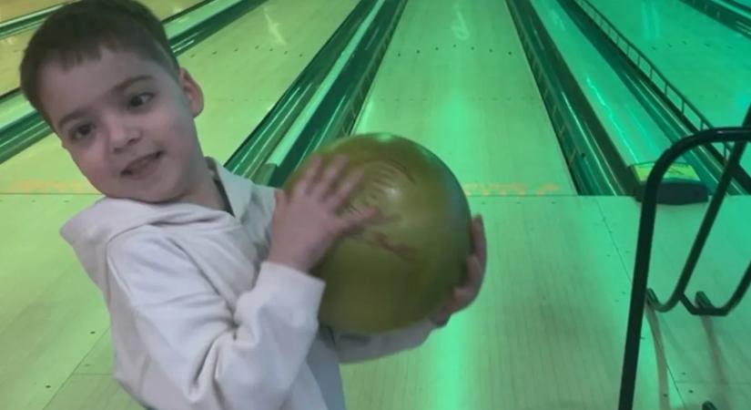 Még az orvosokat is sokkolta: Golflabda-méretű lett a kisfiú szeme