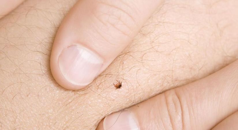 Egy rossz mozdulat is elég lehet: így védekezz a kullancsok ellen túrázás közben (videó)