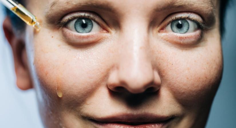 Ha érzékeny a bőröd, akkor is használhatod pattanásokra ezt a hatóanyagot! – Mit keress pontosan az összetevők között?