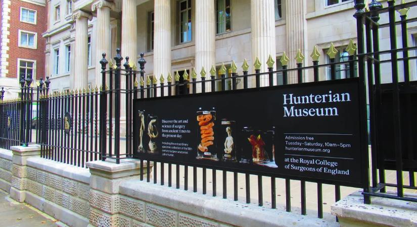 Különleges múzeumok: ezek a világ leghátborzongatóbb anatómiai kiállításai