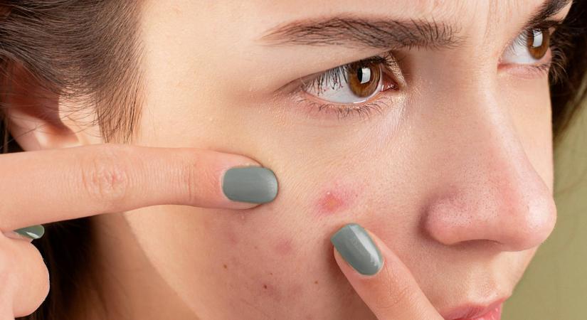 „Ha csíp vagy bizsereg, akkor hat” - A legnagyobb tévhitek, amiket ideje örökre elfelejteni