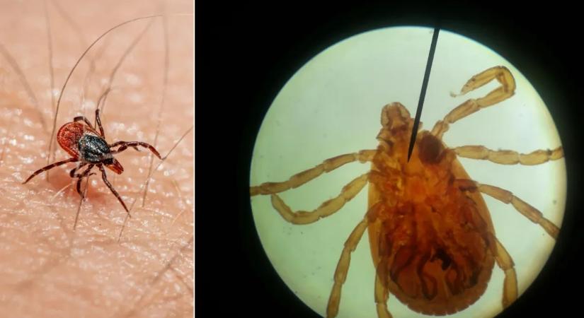 Nyolc láb, csíkos minta és halálos kór: itt az új magyar szuperkullancs!