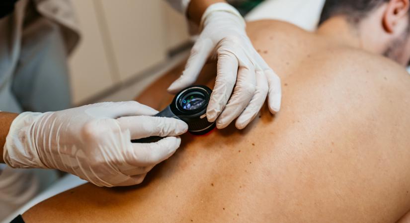 Kvíz: a kék szem növeli a melanoma rizikóját. Igaz vagy hamis? – Teszteld a tudásod!