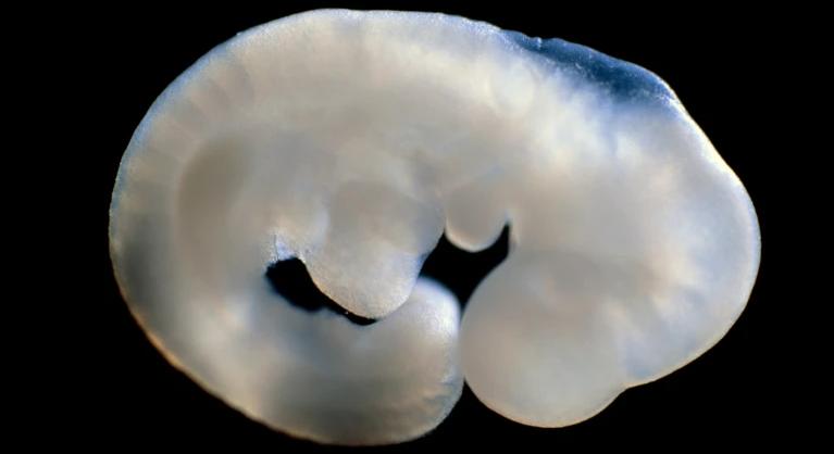 Nemi jellegek gombnyomásra?