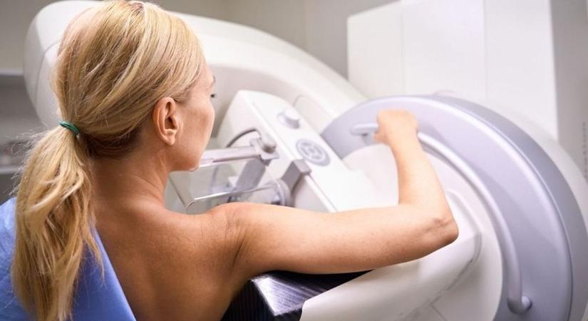 A mammográfia életmentő lehet, de nincs időpont – panaszolja olvasónk